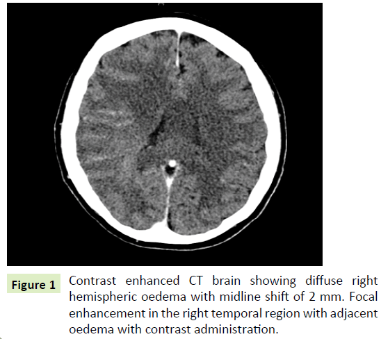 jneuro-Contrast-enhanced