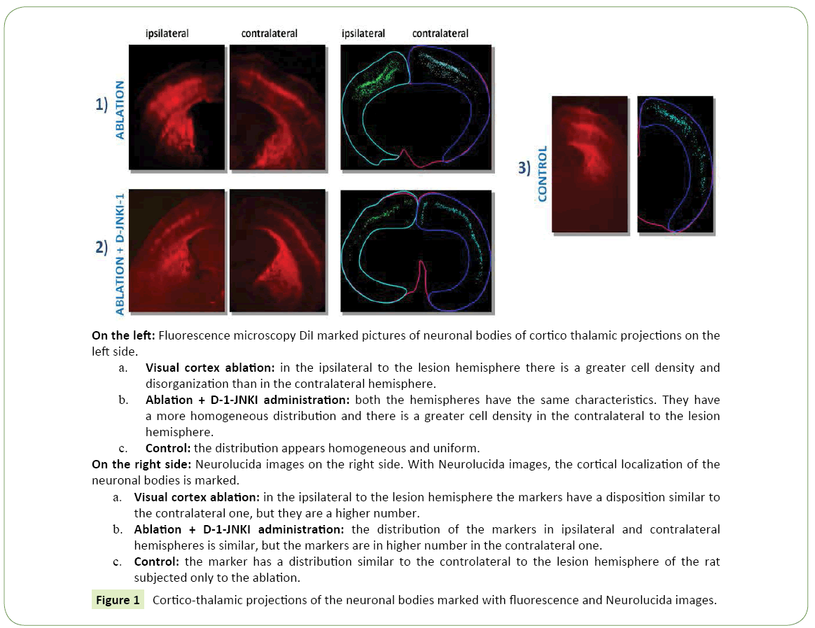 jneuro-Cortico-thalamic