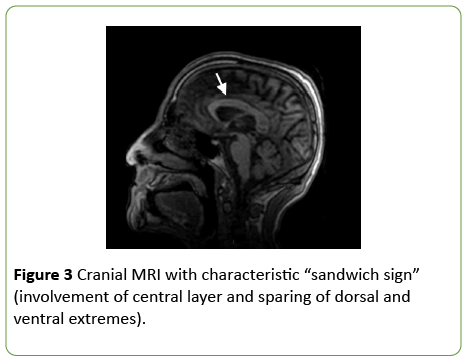jneuro-Cranial-MRI
