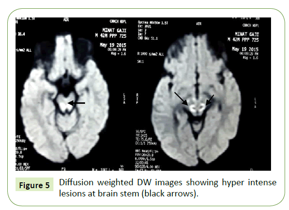 jneuro-Diffusion-weighted