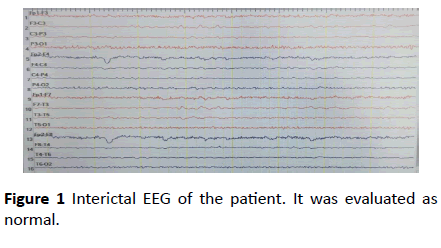 jneuro-EEG-patient