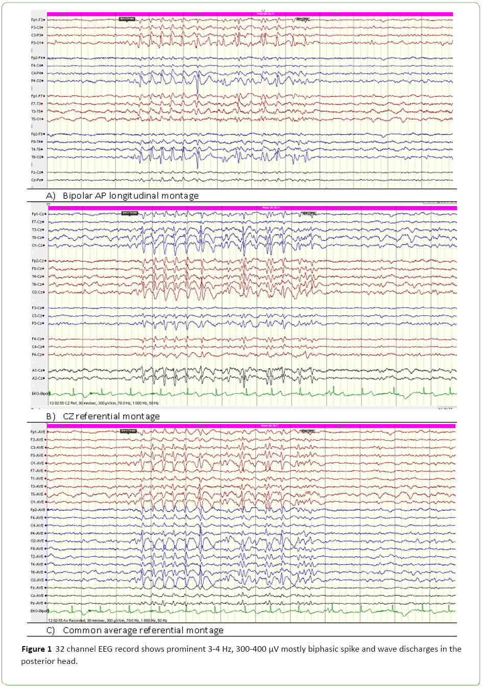 jneuro-EEG-record