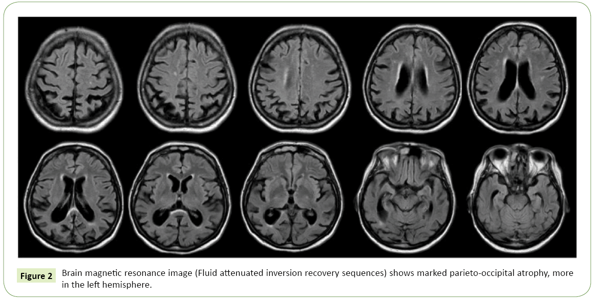 jneuro-Effect-lupeol-Brain-magnetic