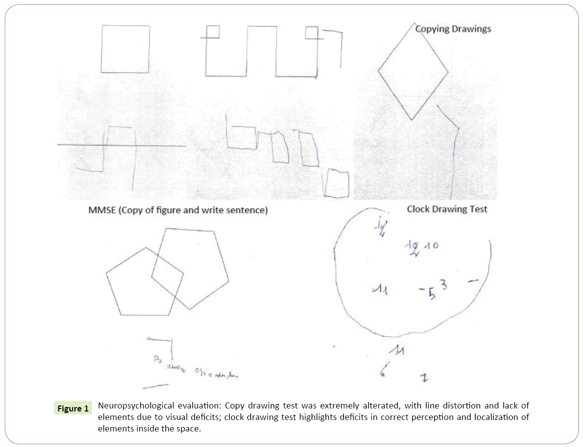 jneuro-Effect-lupeol-line-distortion