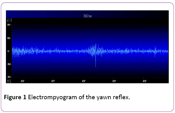 jneuro-Electrompyogram-yawn