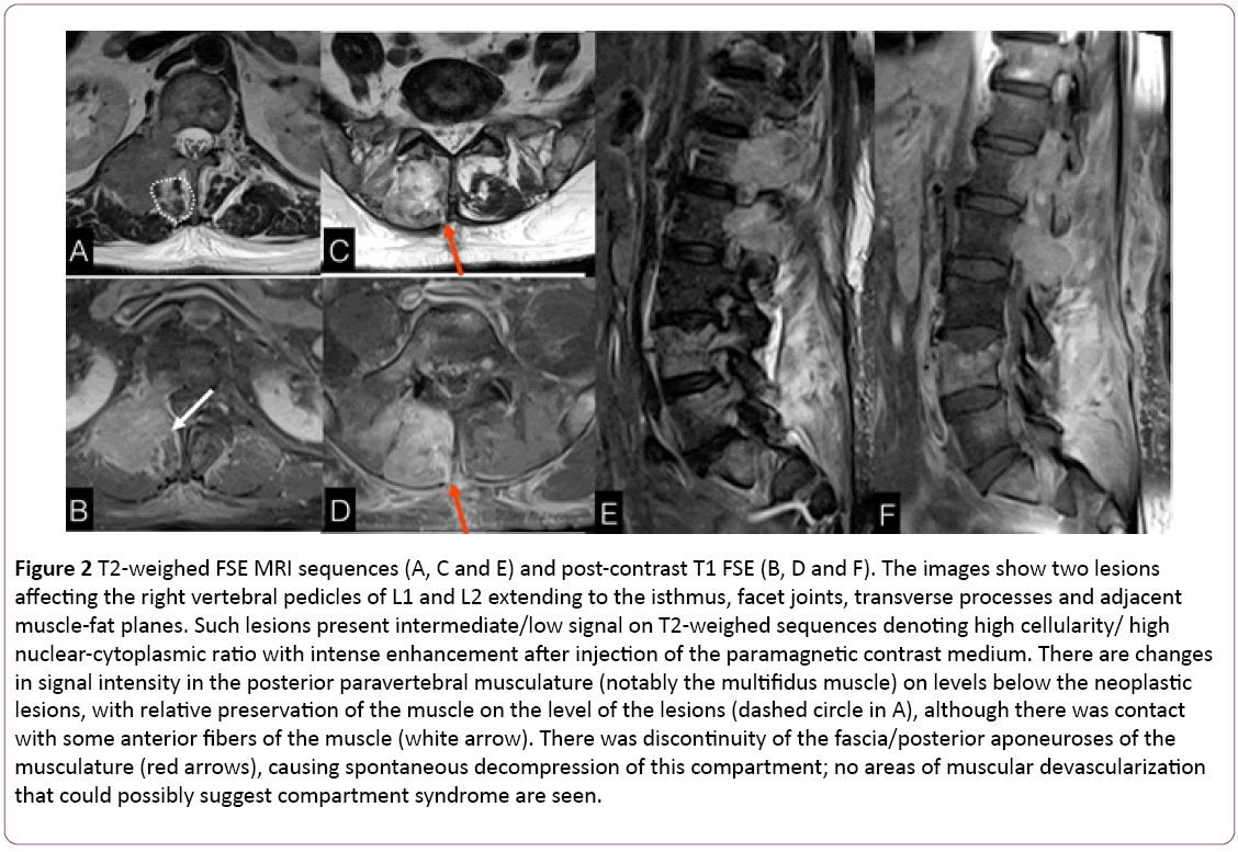 jneuro-FSE-MRI-sequences-post-contrast
