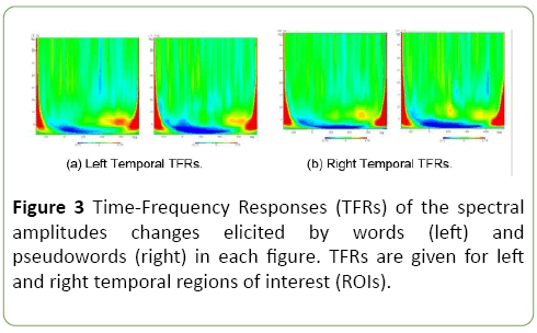 jneuro-Frequency-Responses