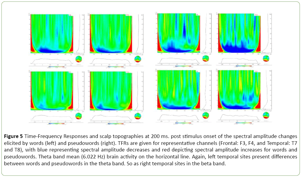 jneuro-Frequency-Responses