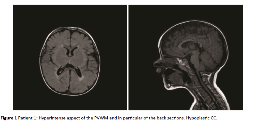 jneuro-Hyperintense-back-sections