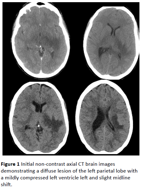 jneuro-Initial-non-contrast-axial