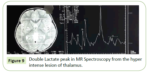 jneuro-MR-Spectroscopy