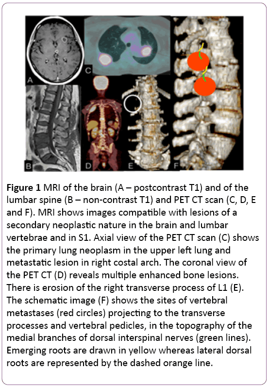 jneuro-MRI-brain-postcontrast-lumbar