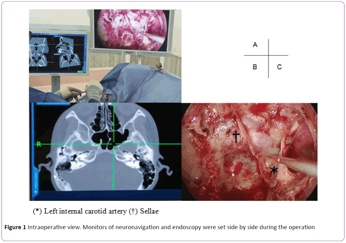 jneuro-Monitors-neuronavigation