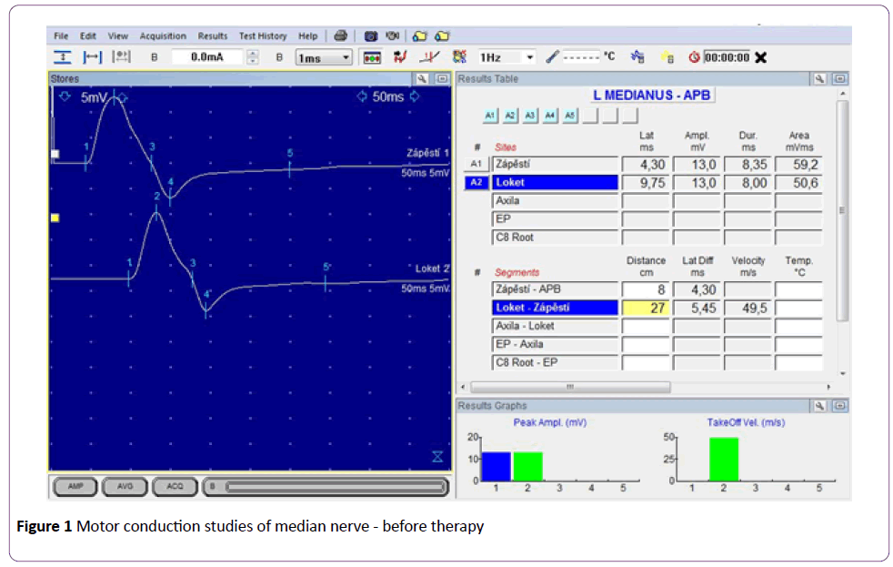 jneuro-Motor-conduction