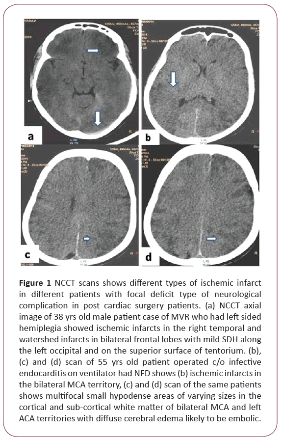 jneuro-NCCT-scans