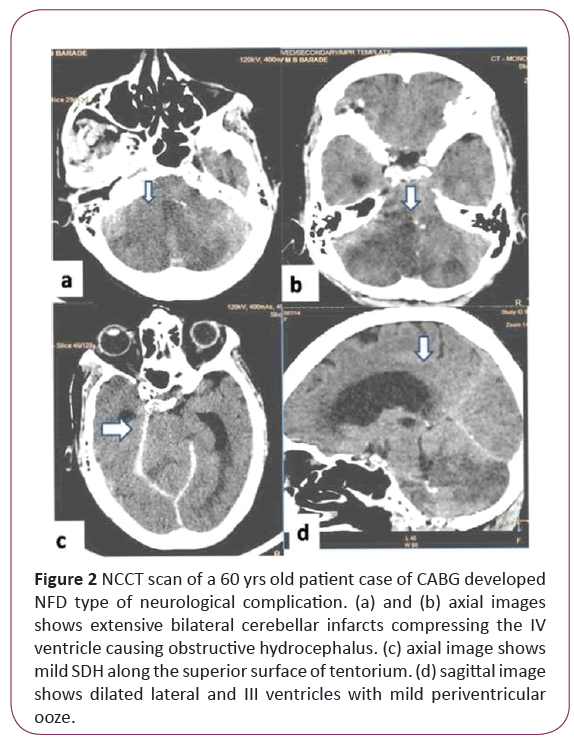 jneuro-NCCT-scans