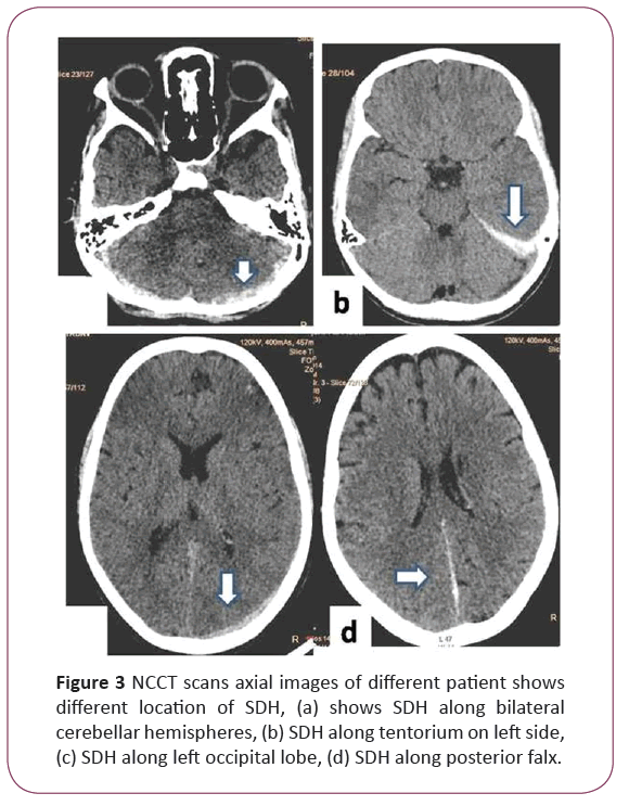 jneuro-NCCT-scans