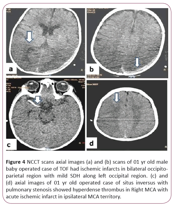 jneuro-NCCT-scans