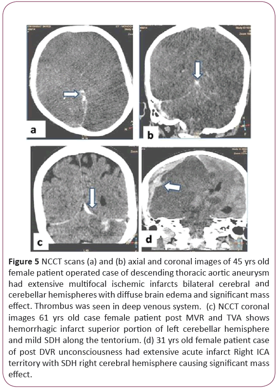 jneuro-NCCT-scans