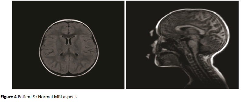 jneuro-Normal-aspect