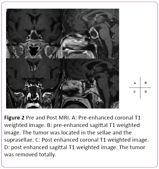 jneuro-Post-MRI