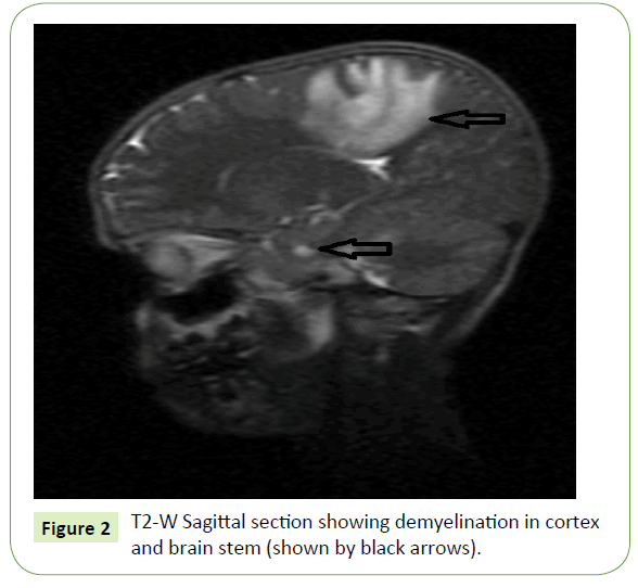 jneuro-Sagittal-section