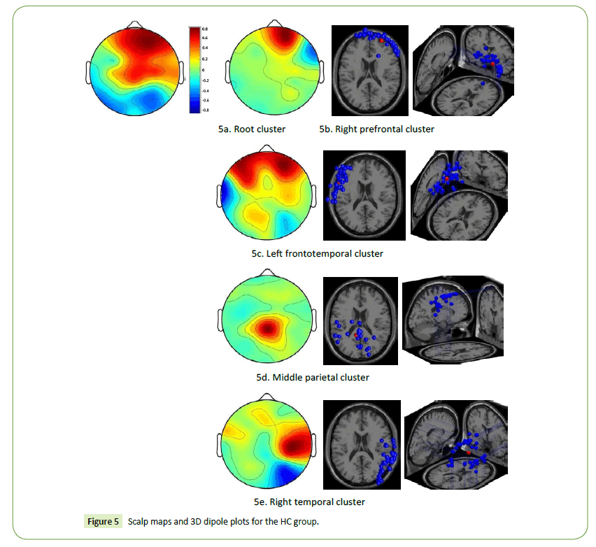 jneuro-Scalp-maps-dipole-plots