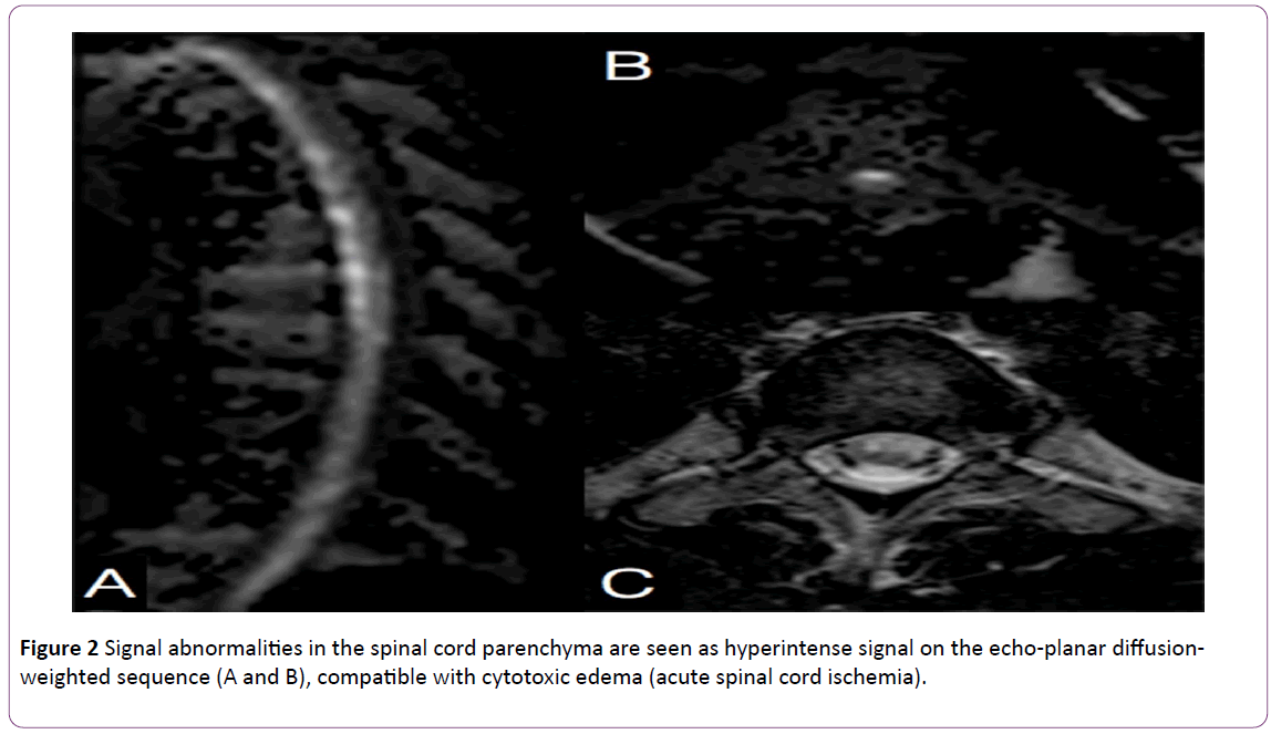 jneuro-Signal-spinal-parenchyma