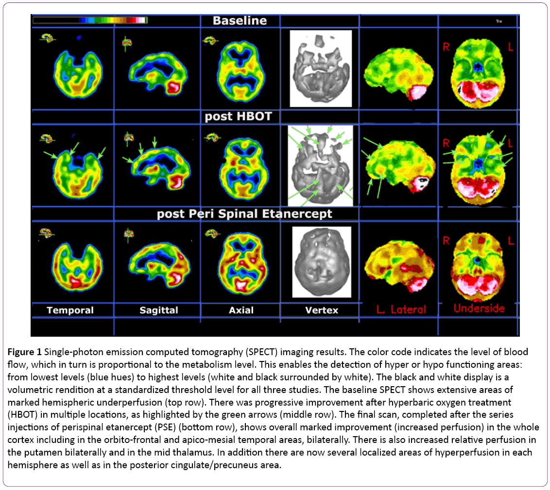 jneuro-Single-photon-emission