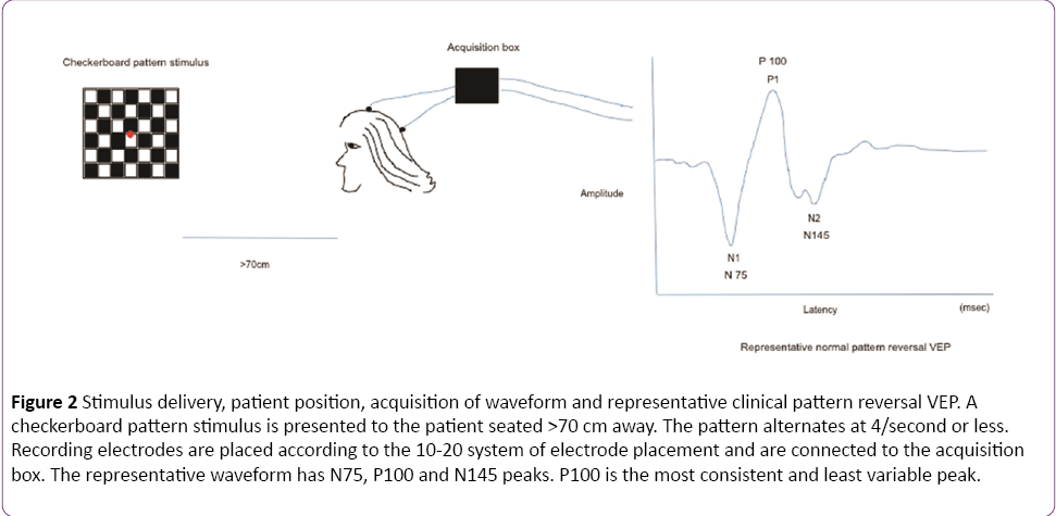 jneuro-Stimulus-patient-acquisition