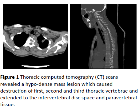 jneuro-Thoracic-computed