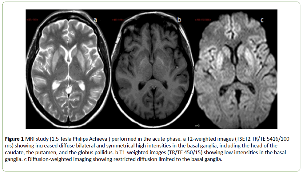 jneuro-acute-phase