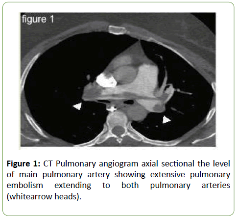 jneuro-angiogram