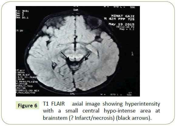 jneuro-axial-image