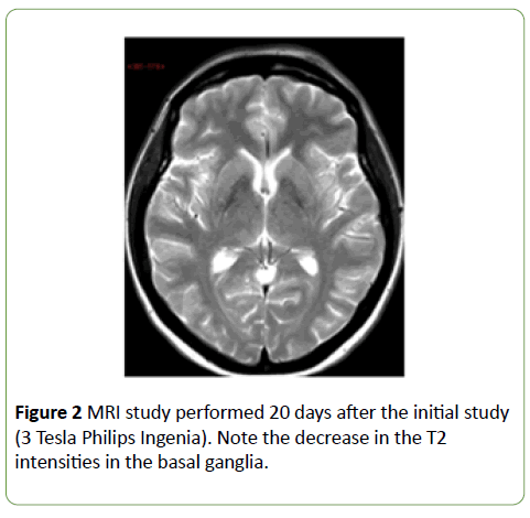 jneuro-basal-ganglia