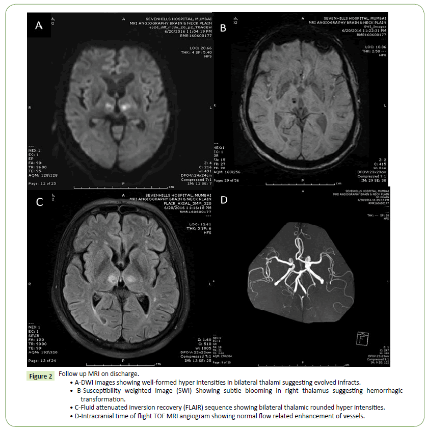 jneuro-bilateral-thalami