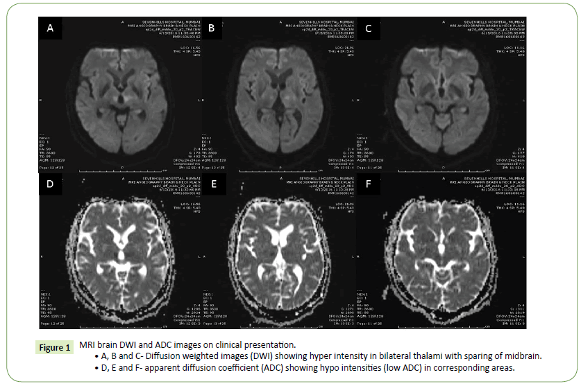 jneuro-blood-supply-thalamus