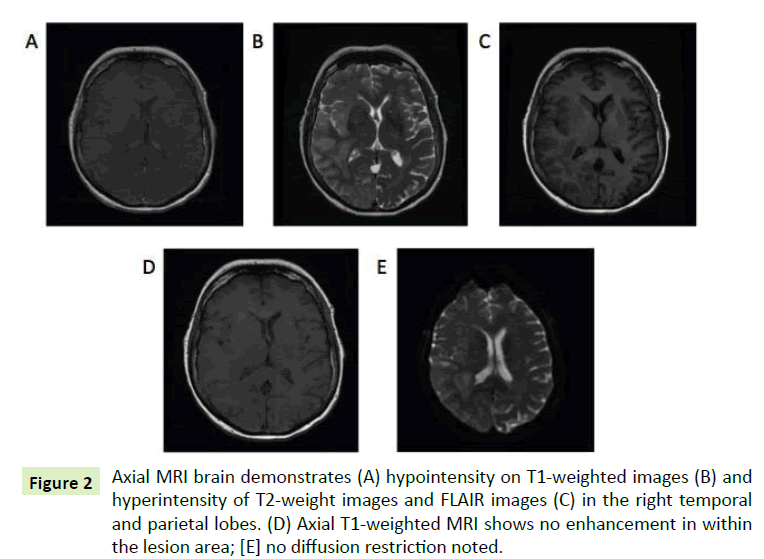 jneuro-brain-demonstrates