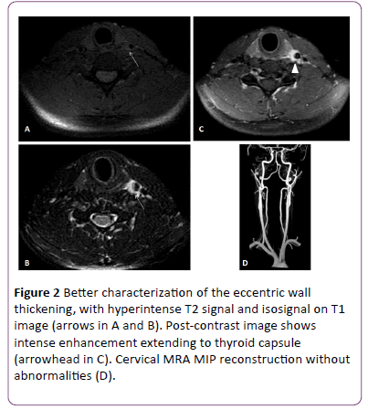 jneuro-characterization-eccentric-wall