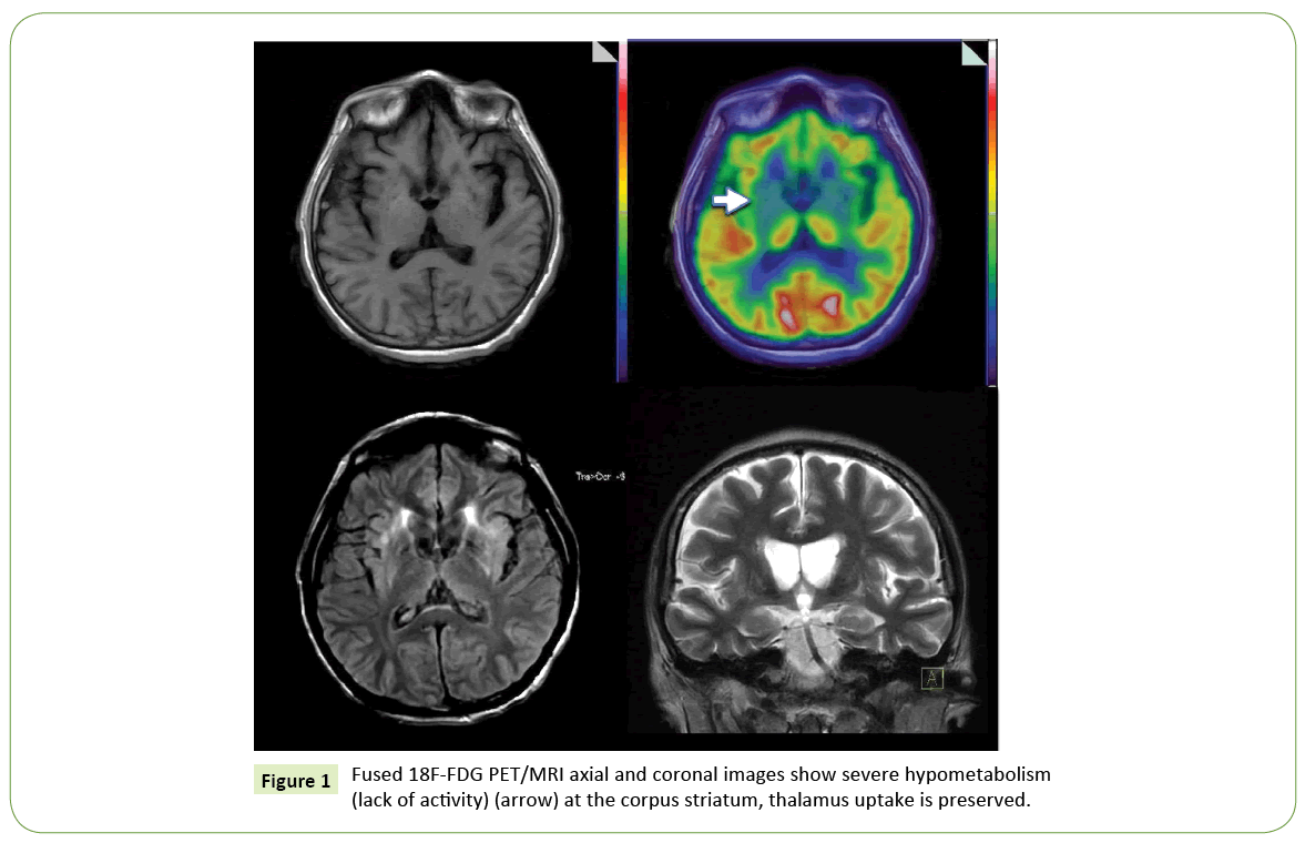 jneuro-coronal-images