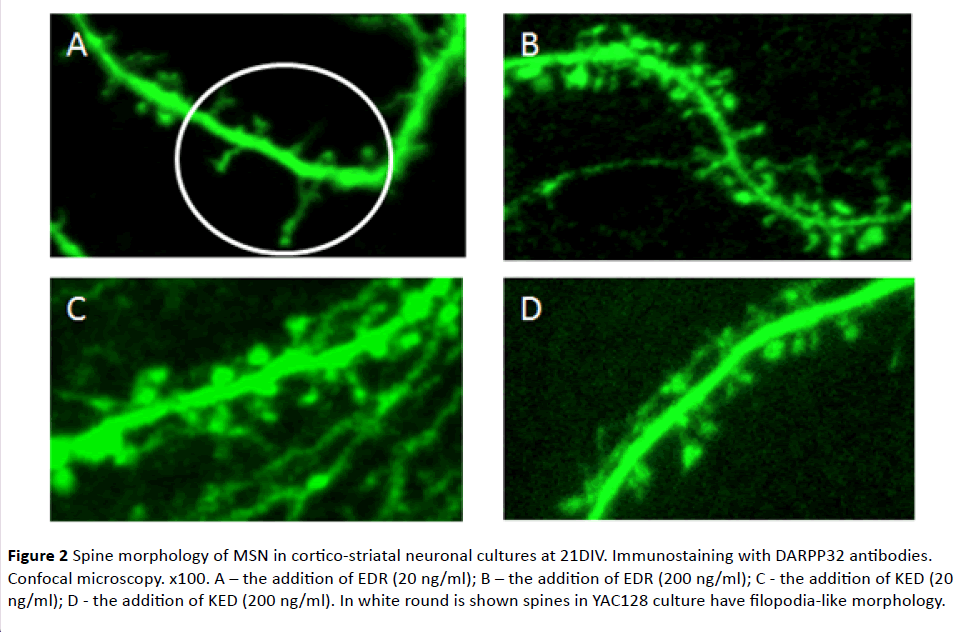 jneuro-cortico-striatal-neuronal