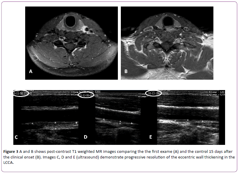 jneuro-demonstrate-progressive-resolution