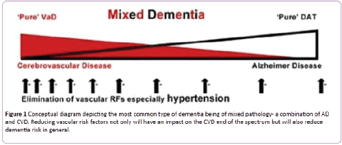 jneuro-diagram-depicting