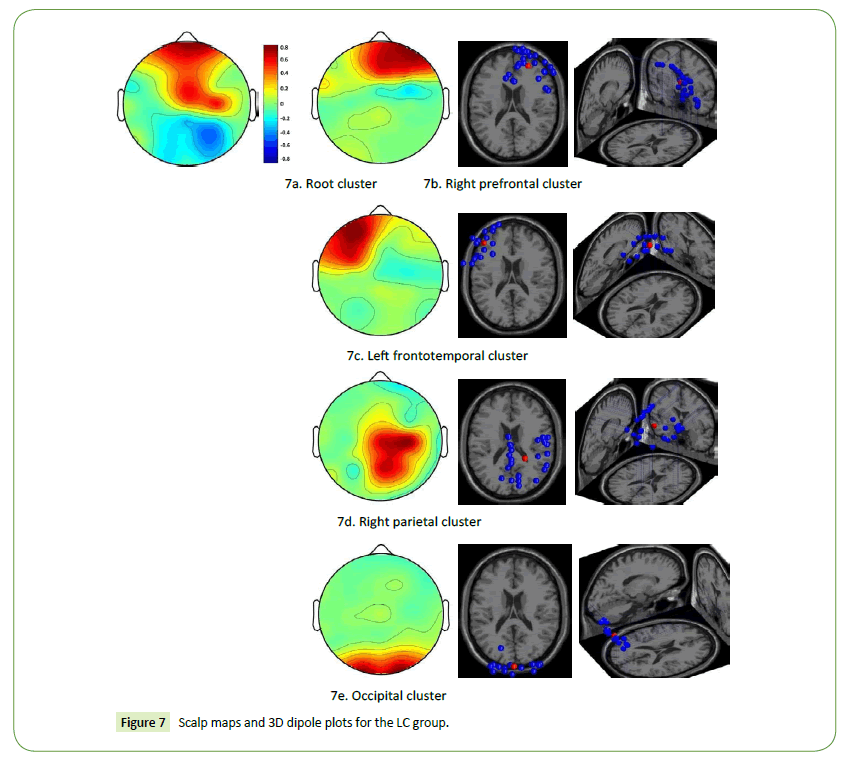 jneuro-dipole-plots-LC-group