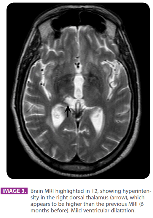 jneuro-dorsal-thalamus