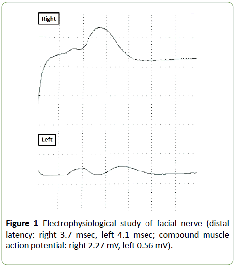 jneuro-electrophysiological