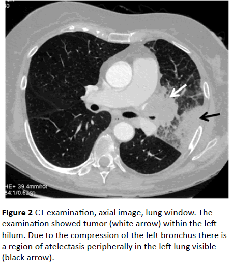 jneuro-examination-axial-image-lung-window