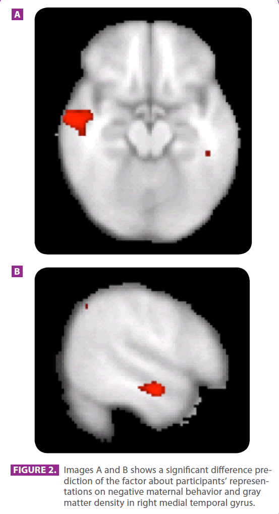 jneuro-gray-matter-density