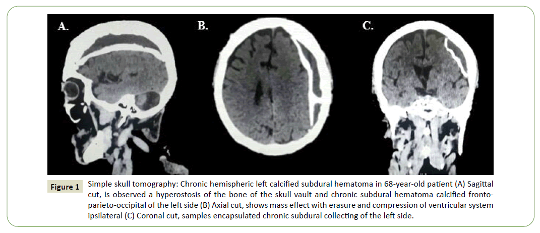 jneuro-hemispheric