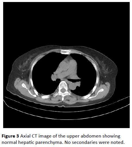 jneuro-hepatic-parenchyma